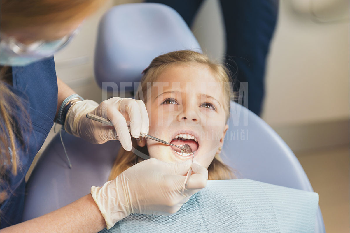 diş çürüğü tedavisi
